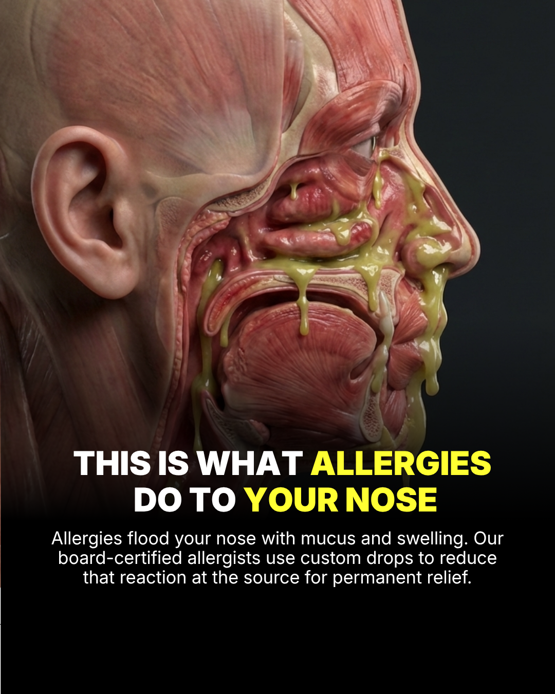 Curex Allergy Facebook ad