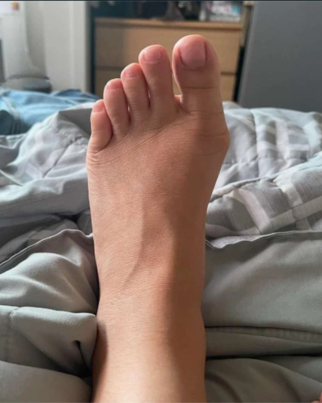 Claire Henderson Facebook ad: What Podiatrists Won't Tell You