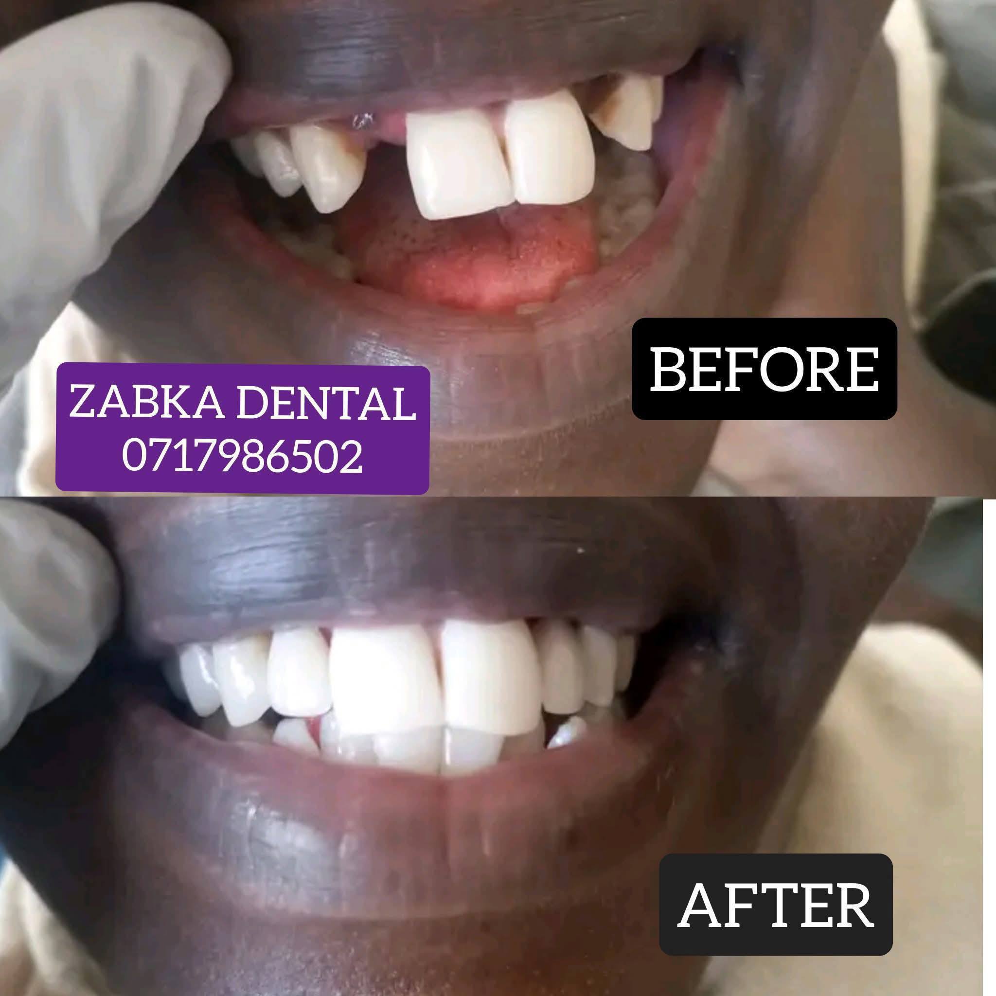 Zabka Dental Services Facebook ad