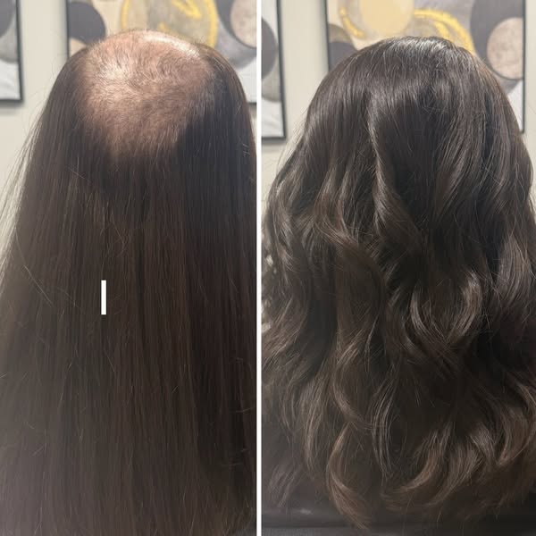 Sarah Patterson Facebook ad: Hair Loss Due to GLP-1