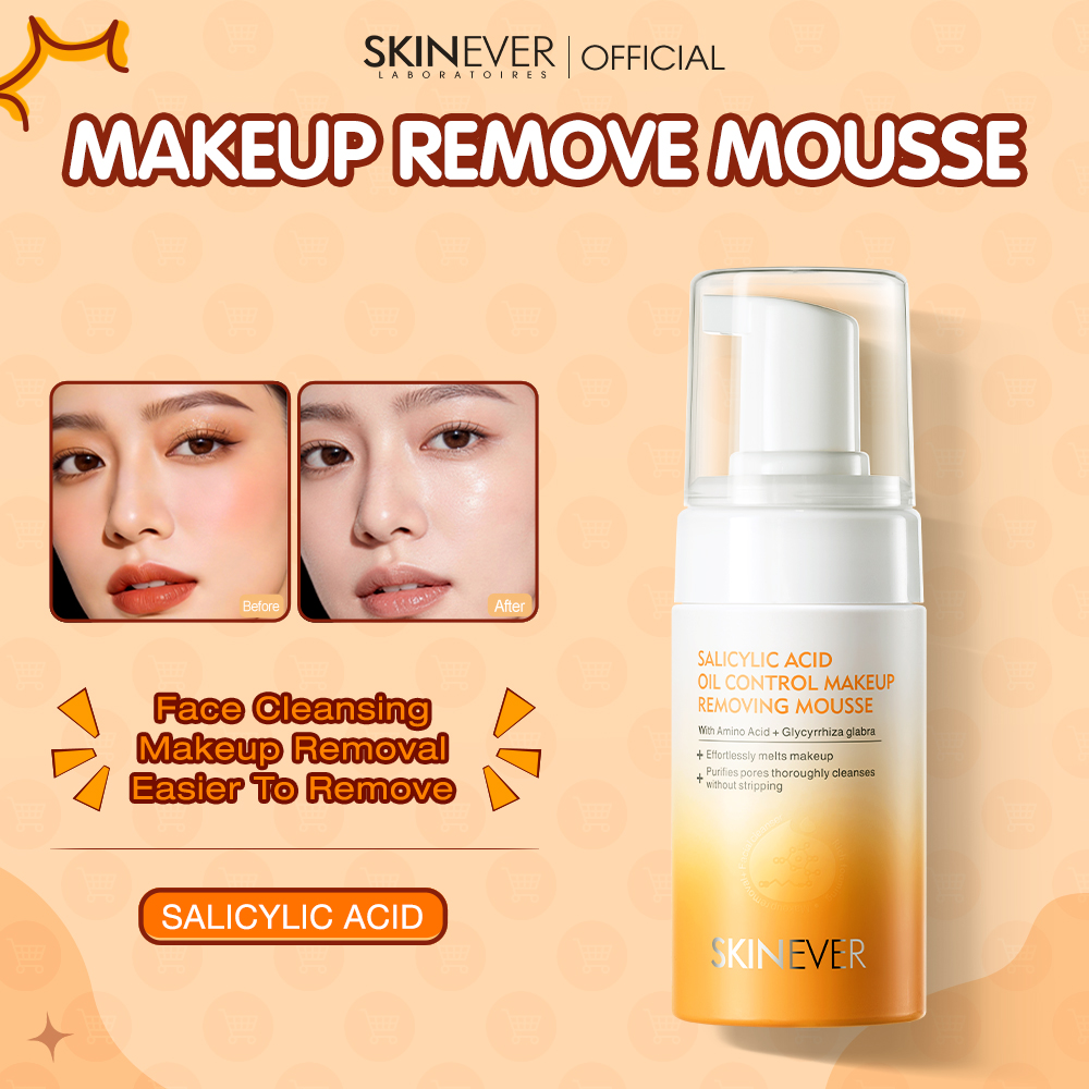 Skinever Facebook ad