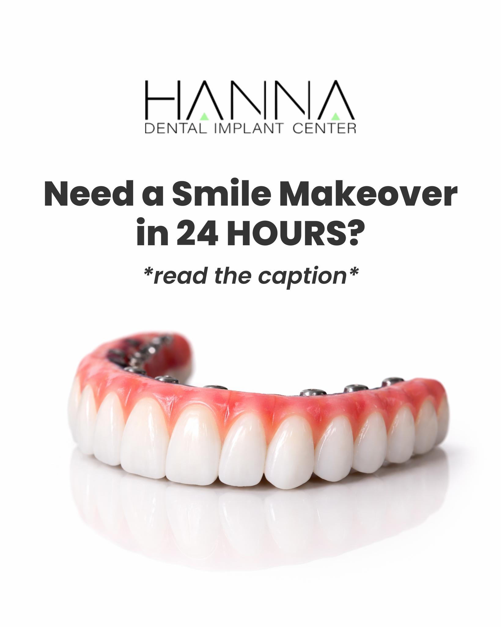 Hanna Dental Implant Center Facebook ad: Take the 30-sec eligibility quiz