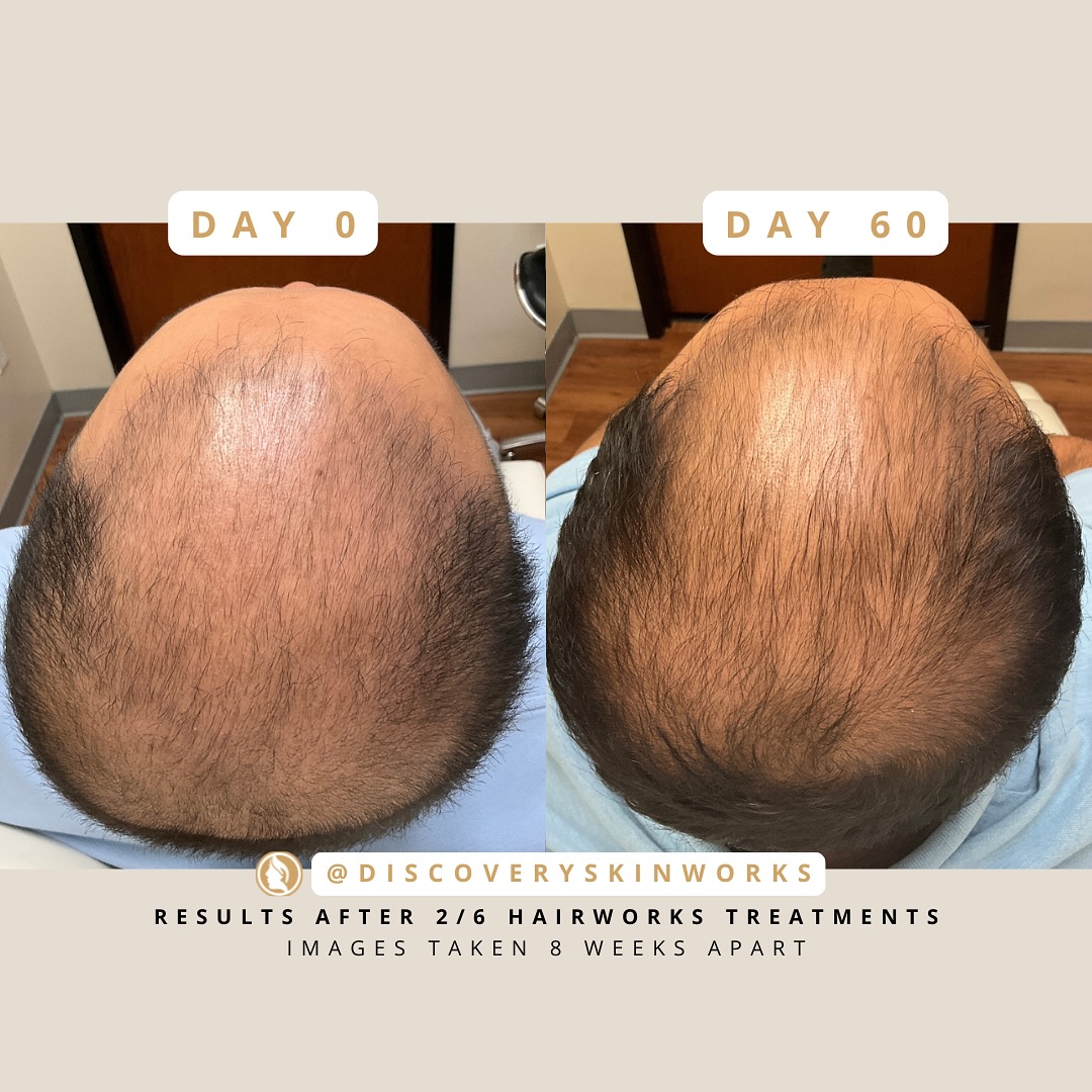 Discovery Skinworks Facebook ad: When this patient came to us, we were…