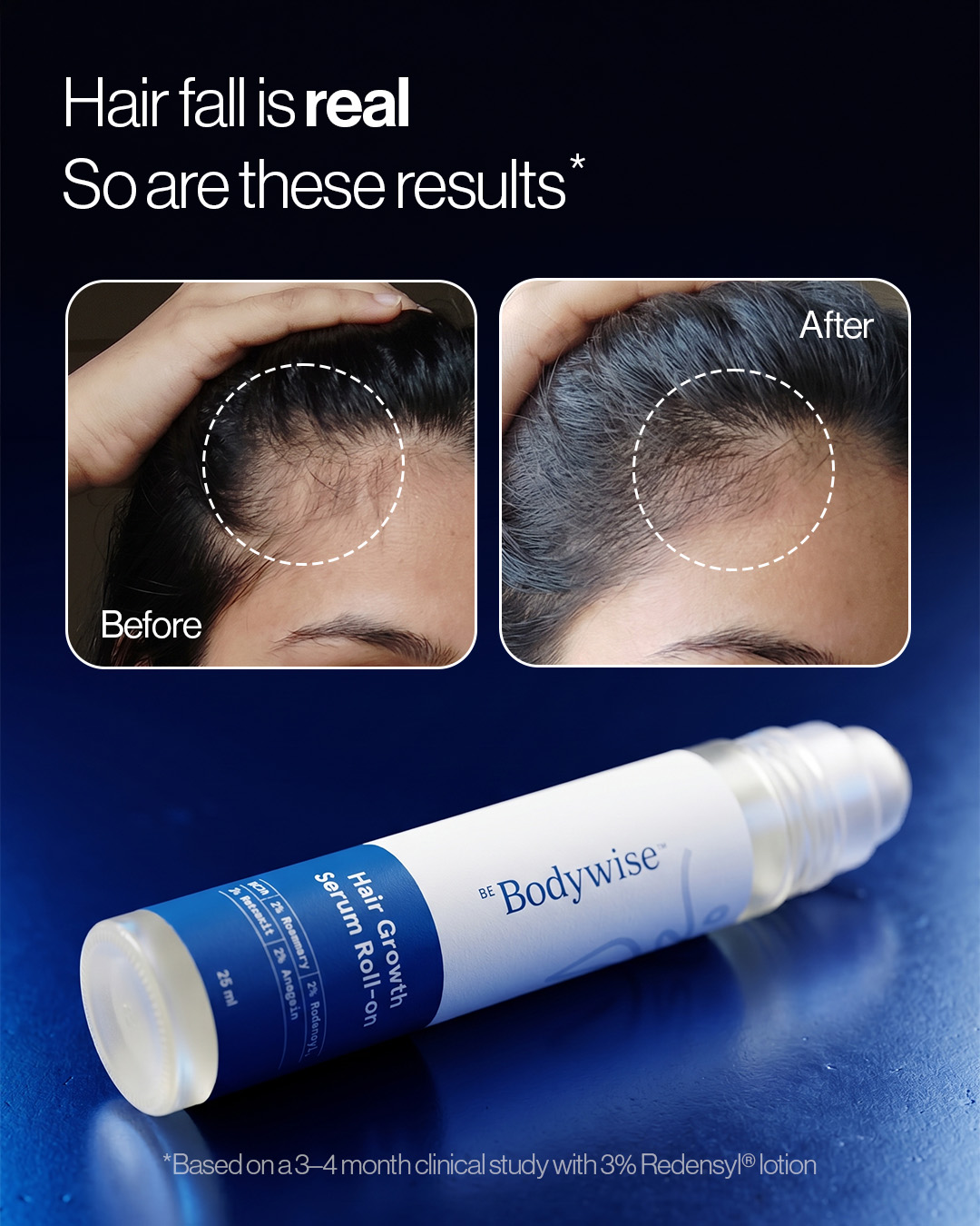 Be Bodywise Facebook ad