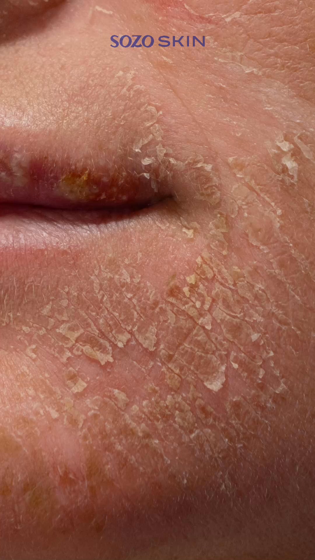 Sozo Skin Clinic Facebook ad from Aug 14, 2026