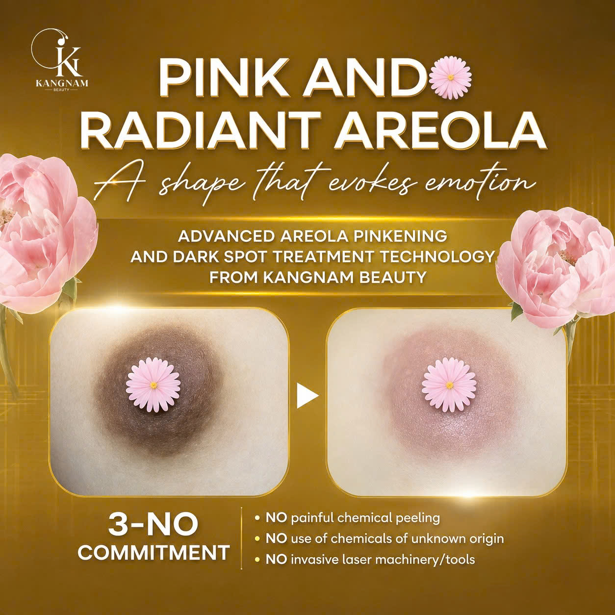 Kangnam Beauty Spa - Manila Facebook ad