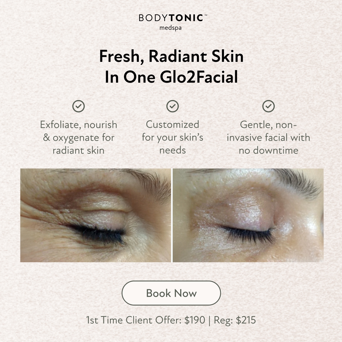 Bodytonic Medspa Facebook ad