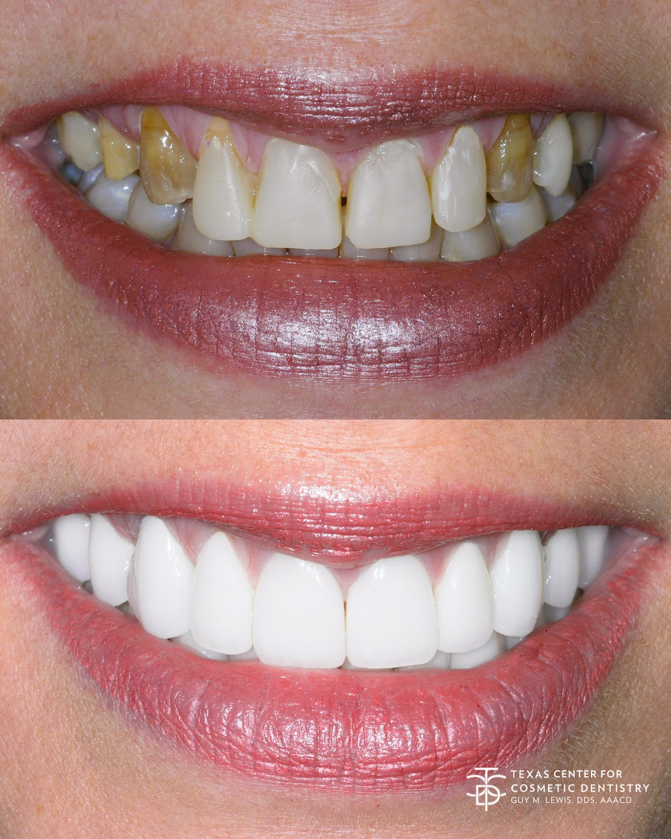 Texas Center for Cosmetic Dentistry by Dr. Guy M. Lewis Facebook ad: Houston, TX Cosmetic Dentist | Dr. Guy M. Lewis