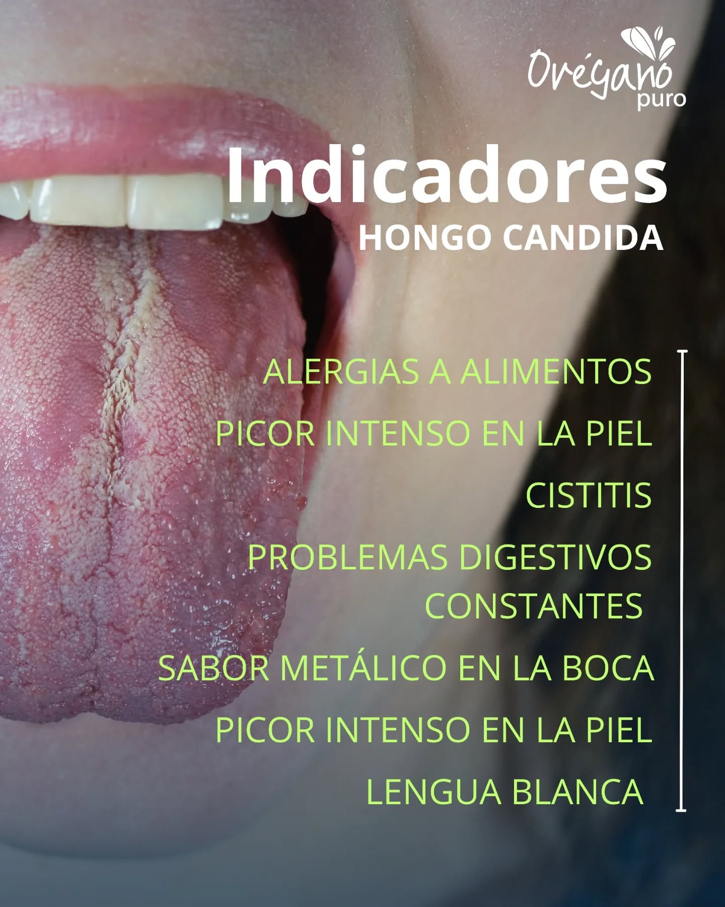aceiteoregano Facebook ad: ¿Tu cuerpo te pide azúcar a gritos o…