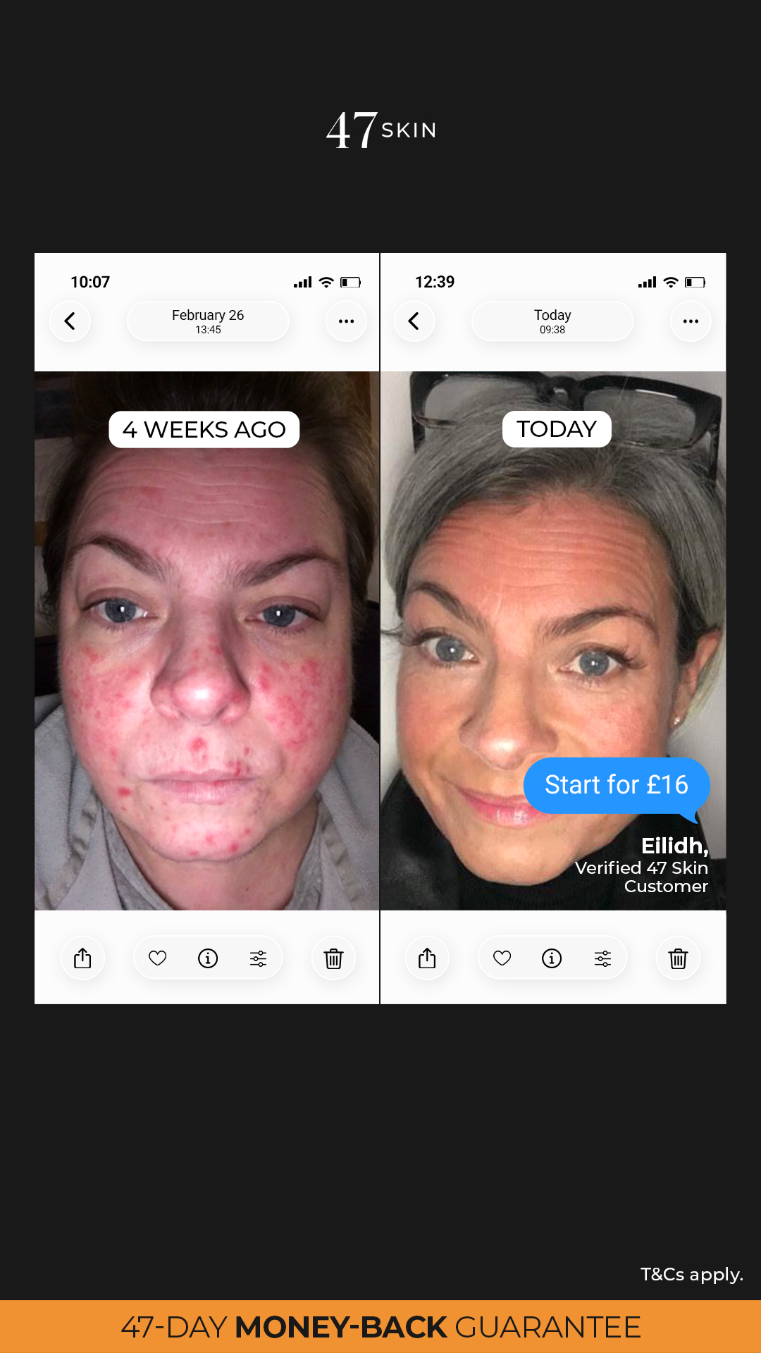 47Skin Facebook ad