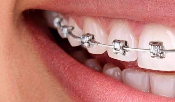 Sonrisa Bonita Morelia Facebook ad: ¿Buscas una sonrisa más cómoda y eficiente?