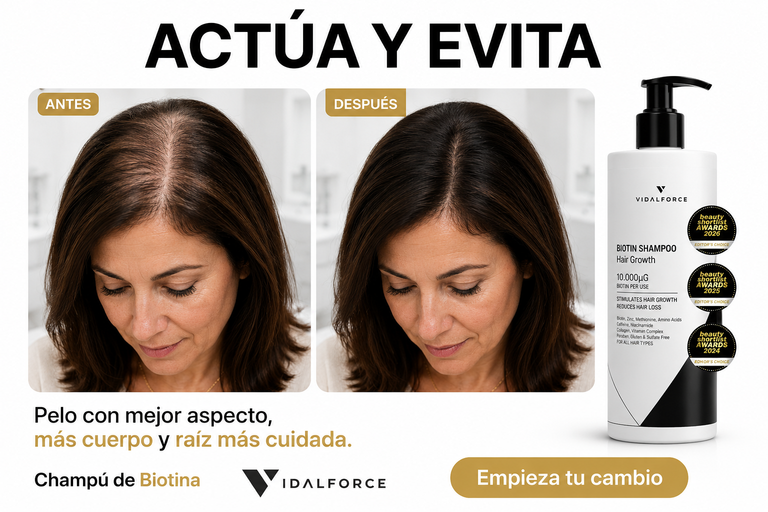 VidalForce Facebook ad: Tratamientos anticaida naturales y ecologicos