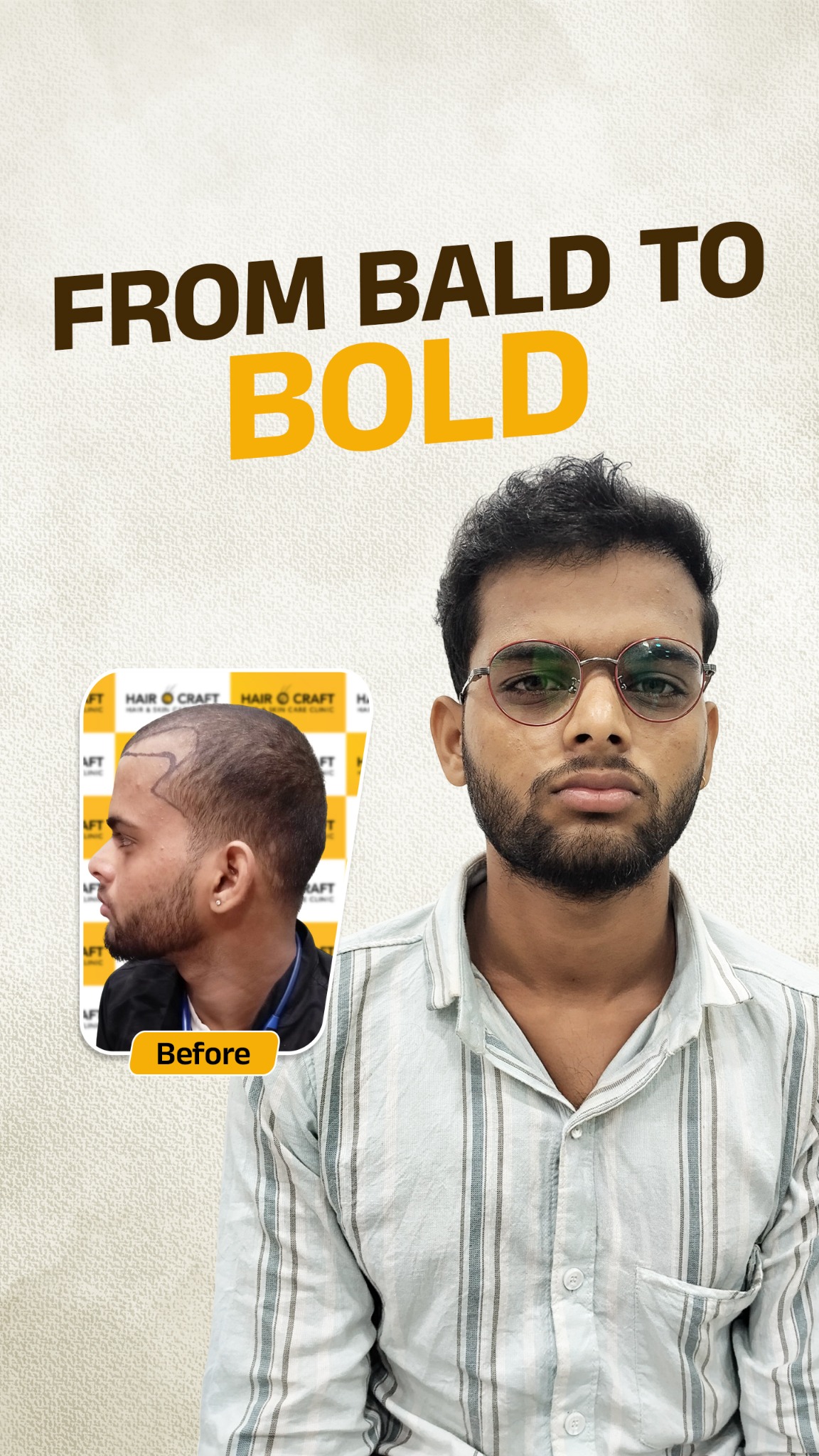 Hair Transplant India Facebook ad