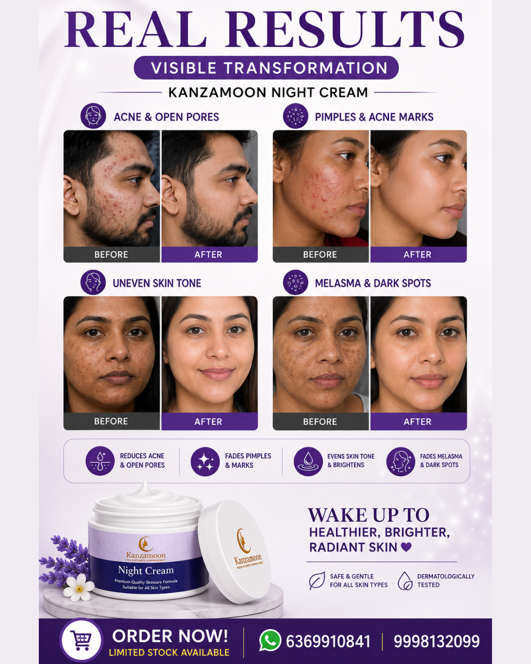Kanzamoon Beauty Facebook ad: Limited Time Offer, Order Today!