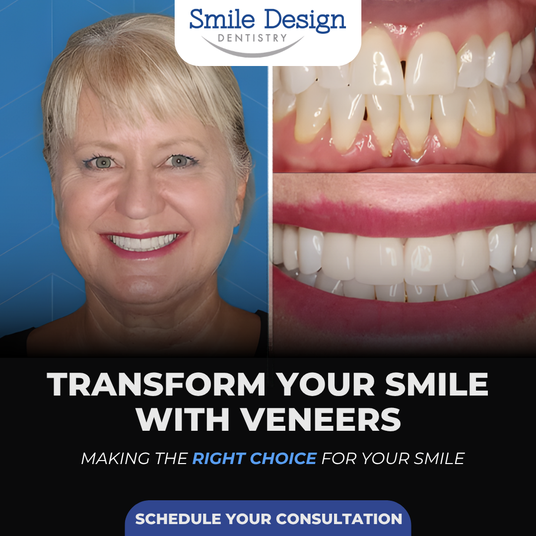 Smile Design Dentistry Facebook ad