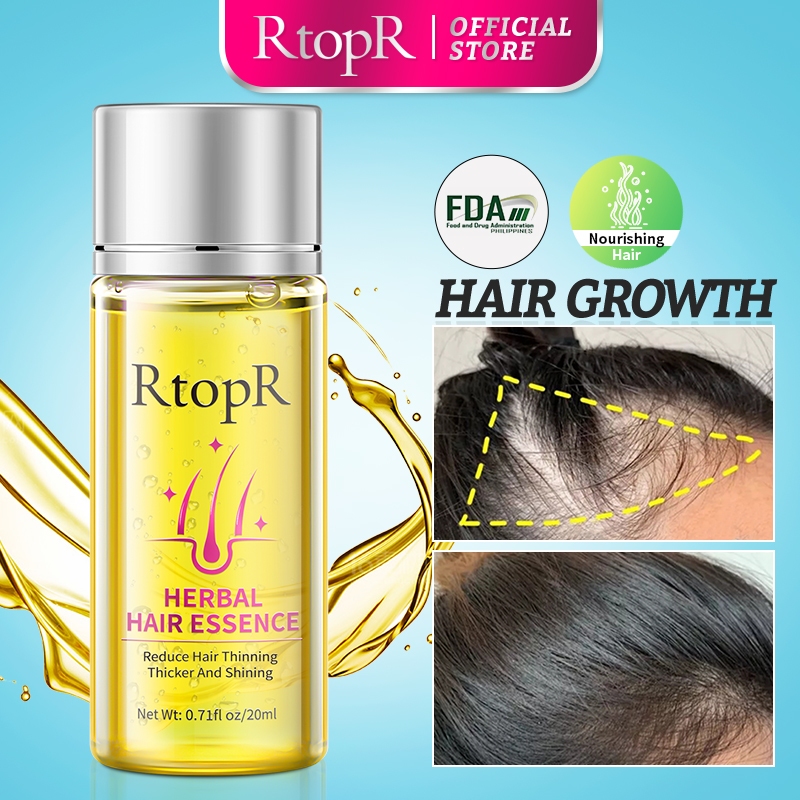 Rtopr Facebook ad