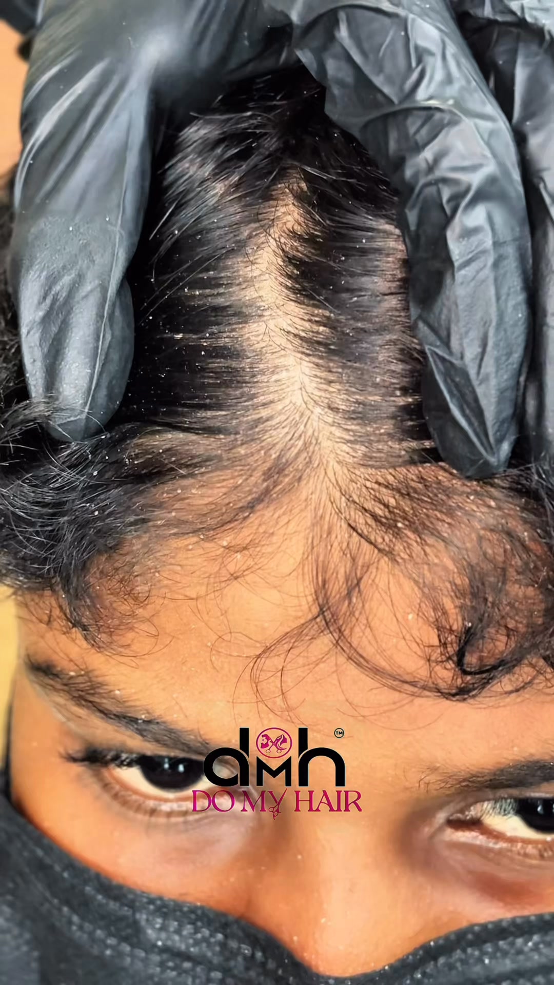 DMH Kilimanoor Facebook ad: Anti-Dandruff Treatment at DMH