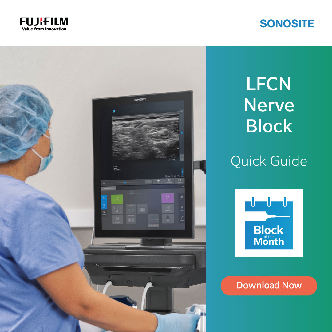 Fujifilm Sonosite Facebook ad