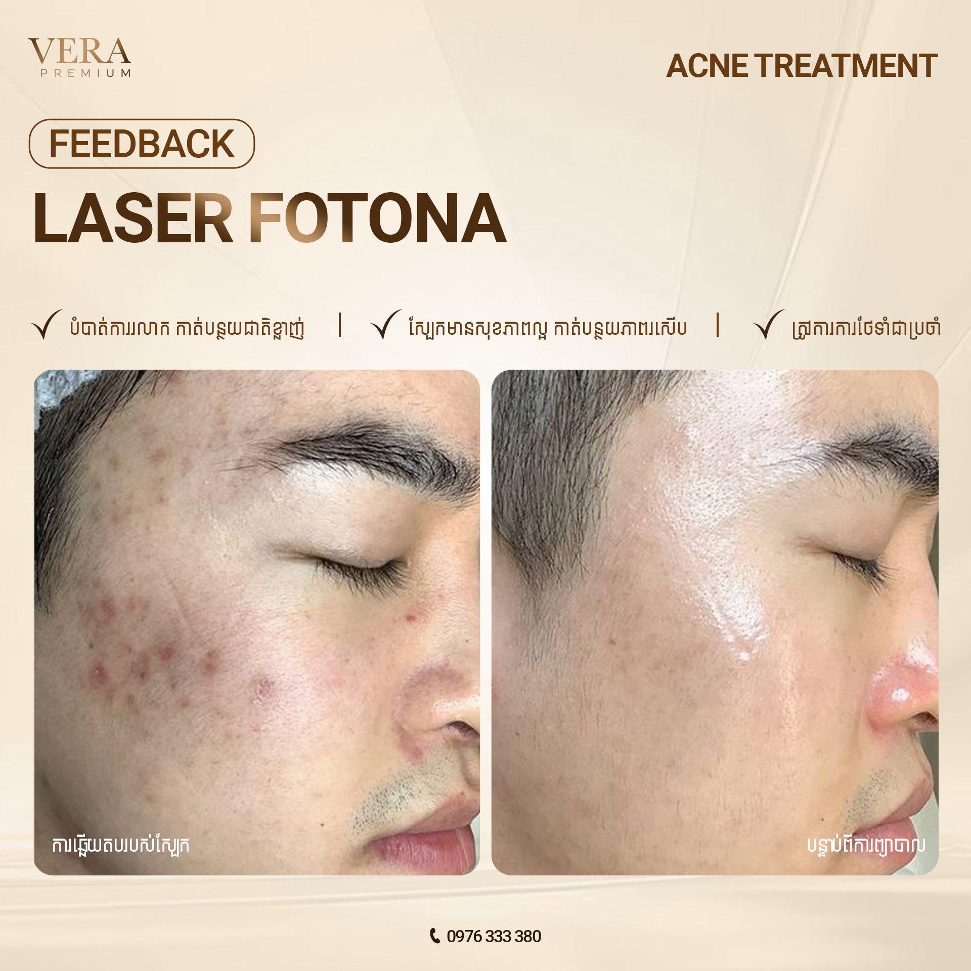Vera Premium - Vera ព្រីមៀម Facebook ad: (English below) យូរណាស់មកហើយចាប់តាំងពី Vera Premium…