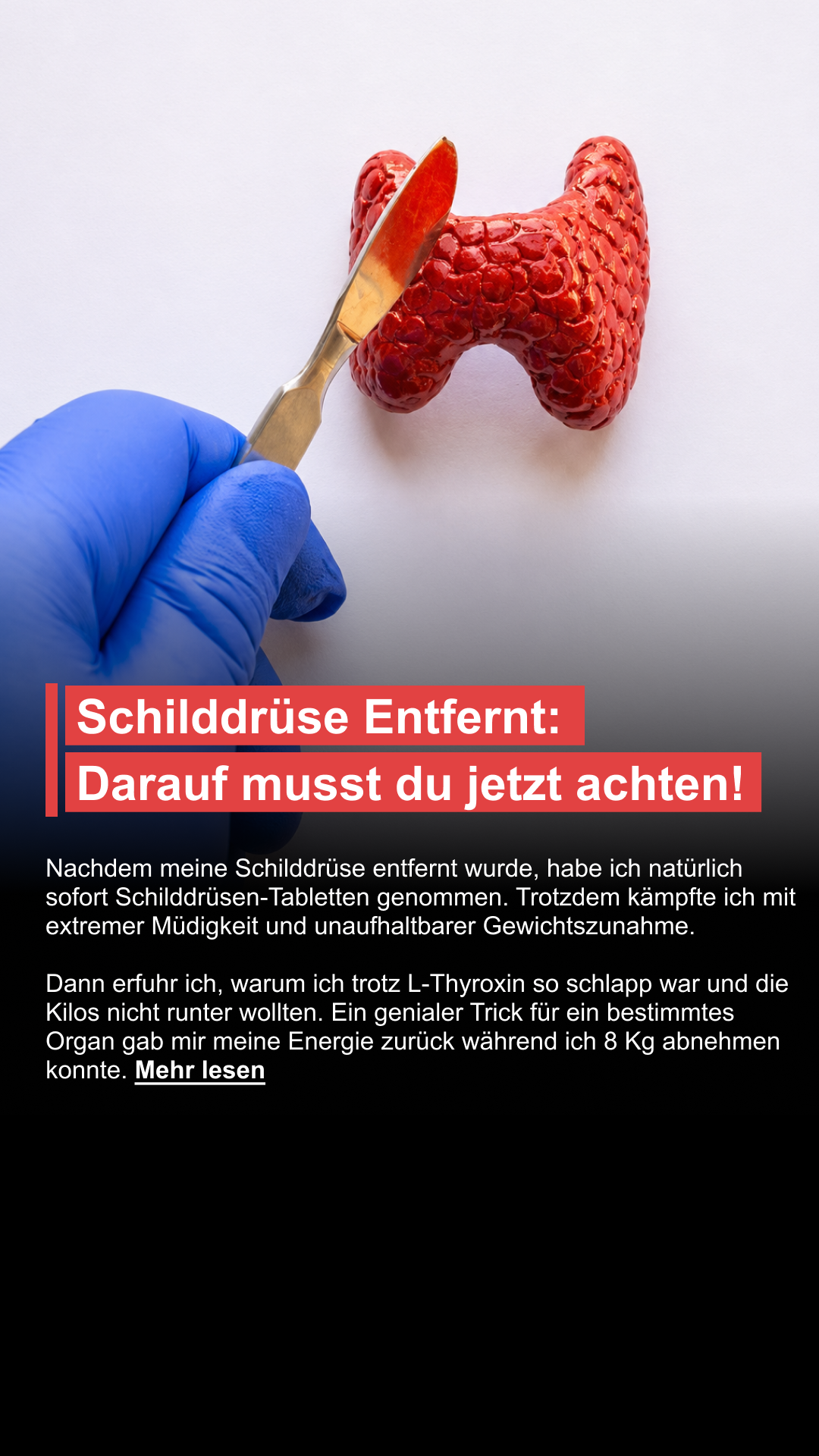 Mission Schilddrüse Facebook ad