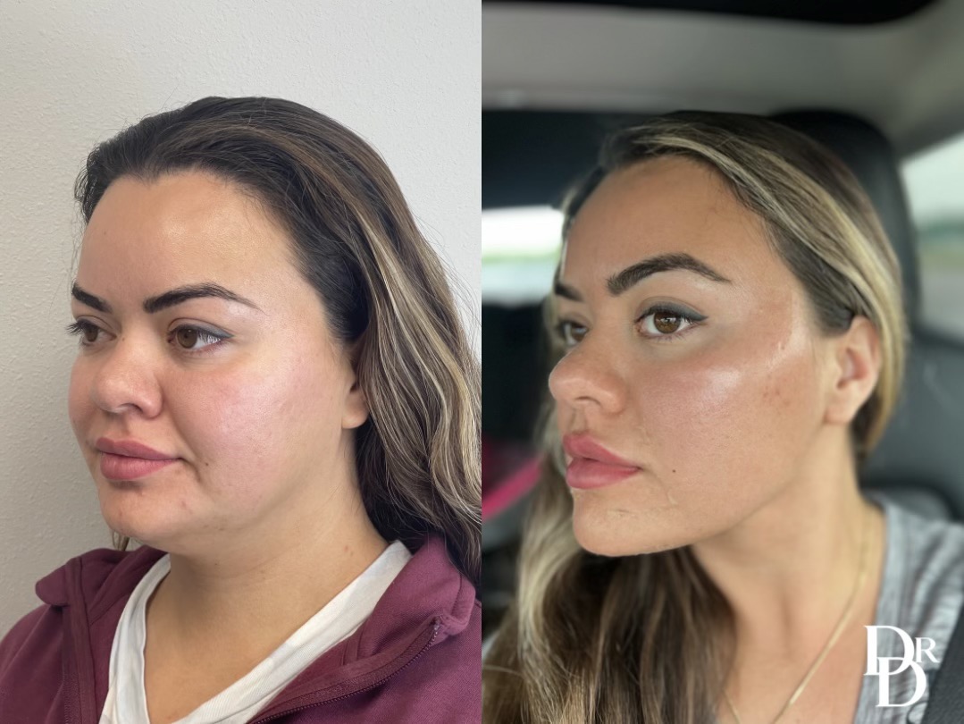 Demetri Arnaoutakis, MD Facebook ad: Looking for a snatched jawline?