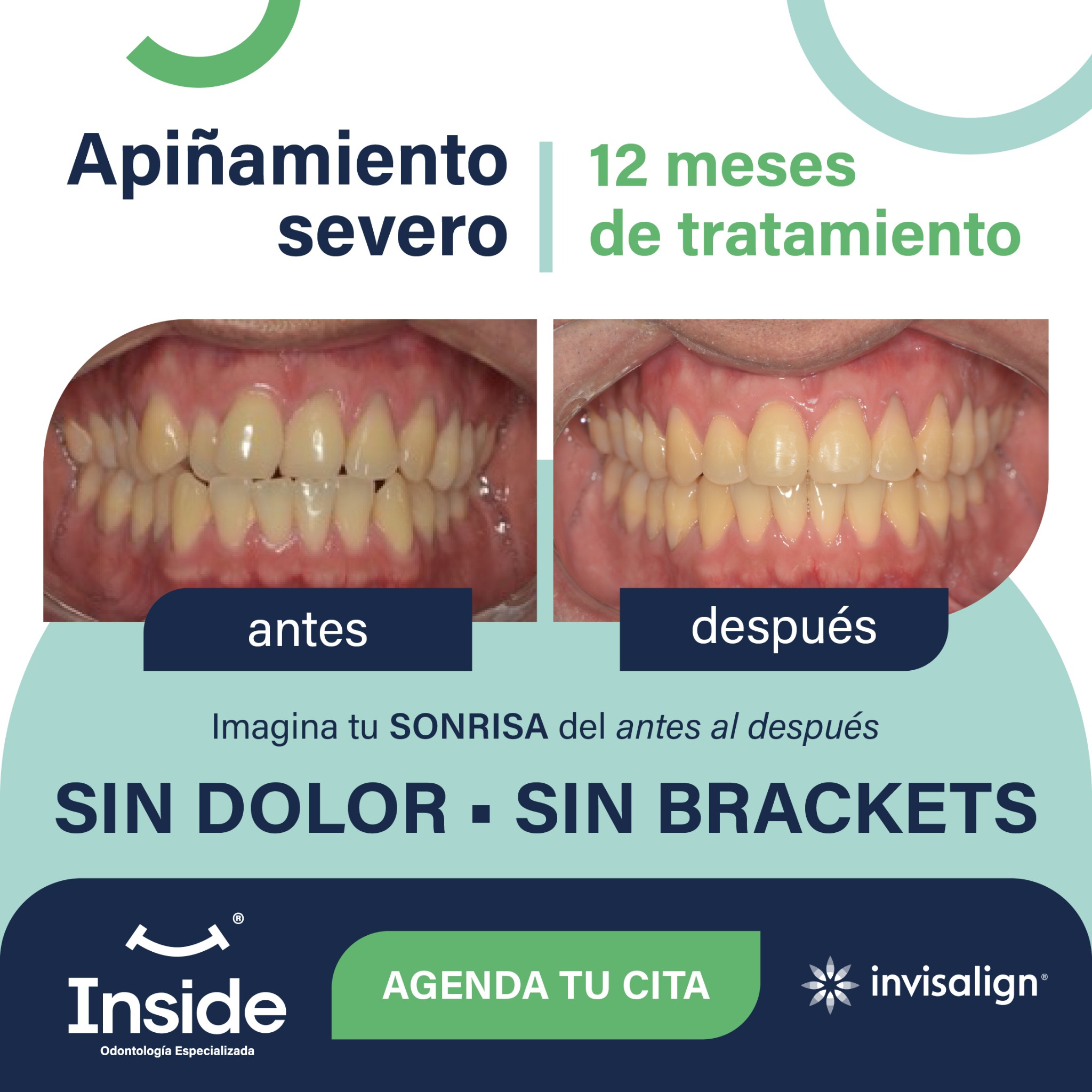 Inside Odontología Especializada Facebook ad