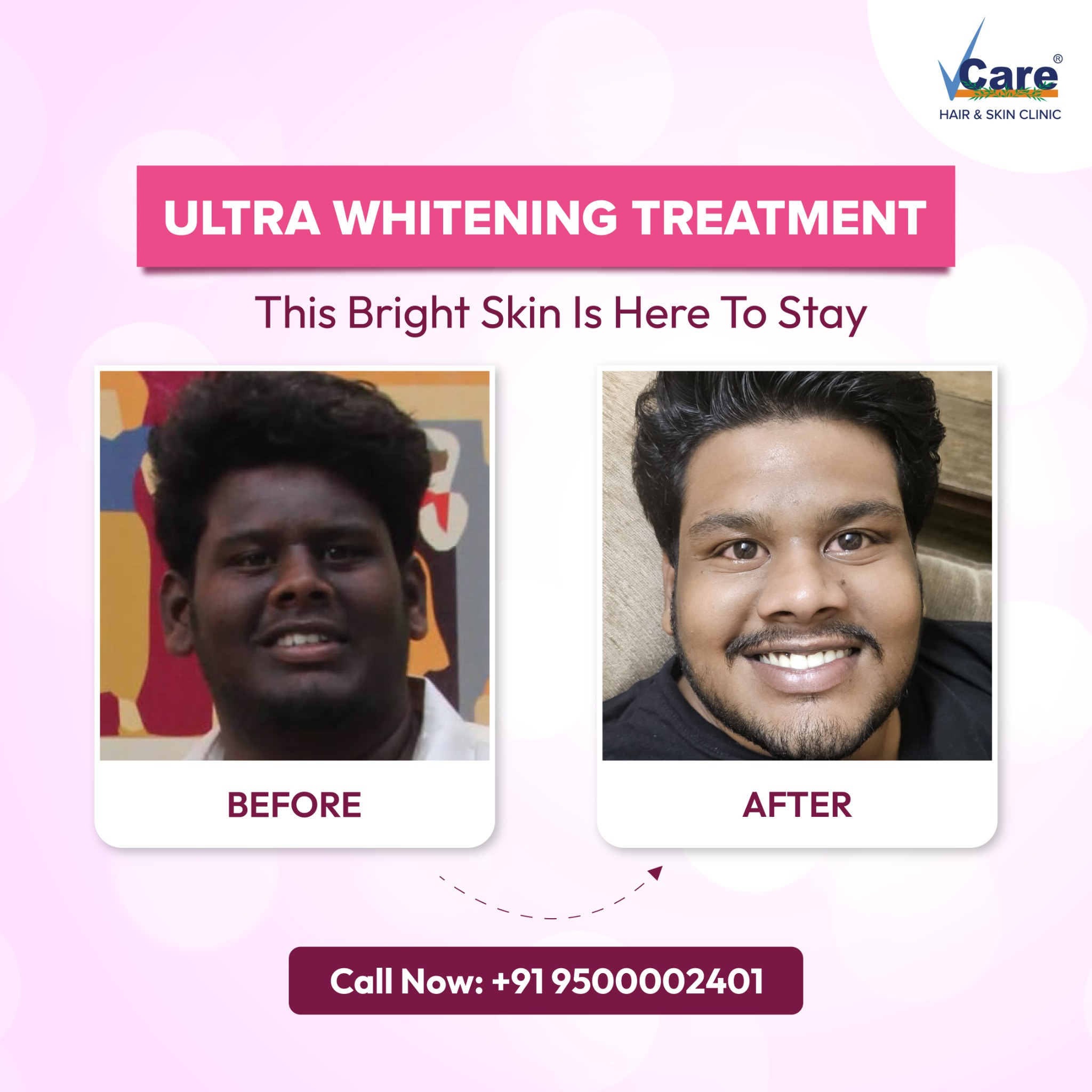 VCare West Facebook ad