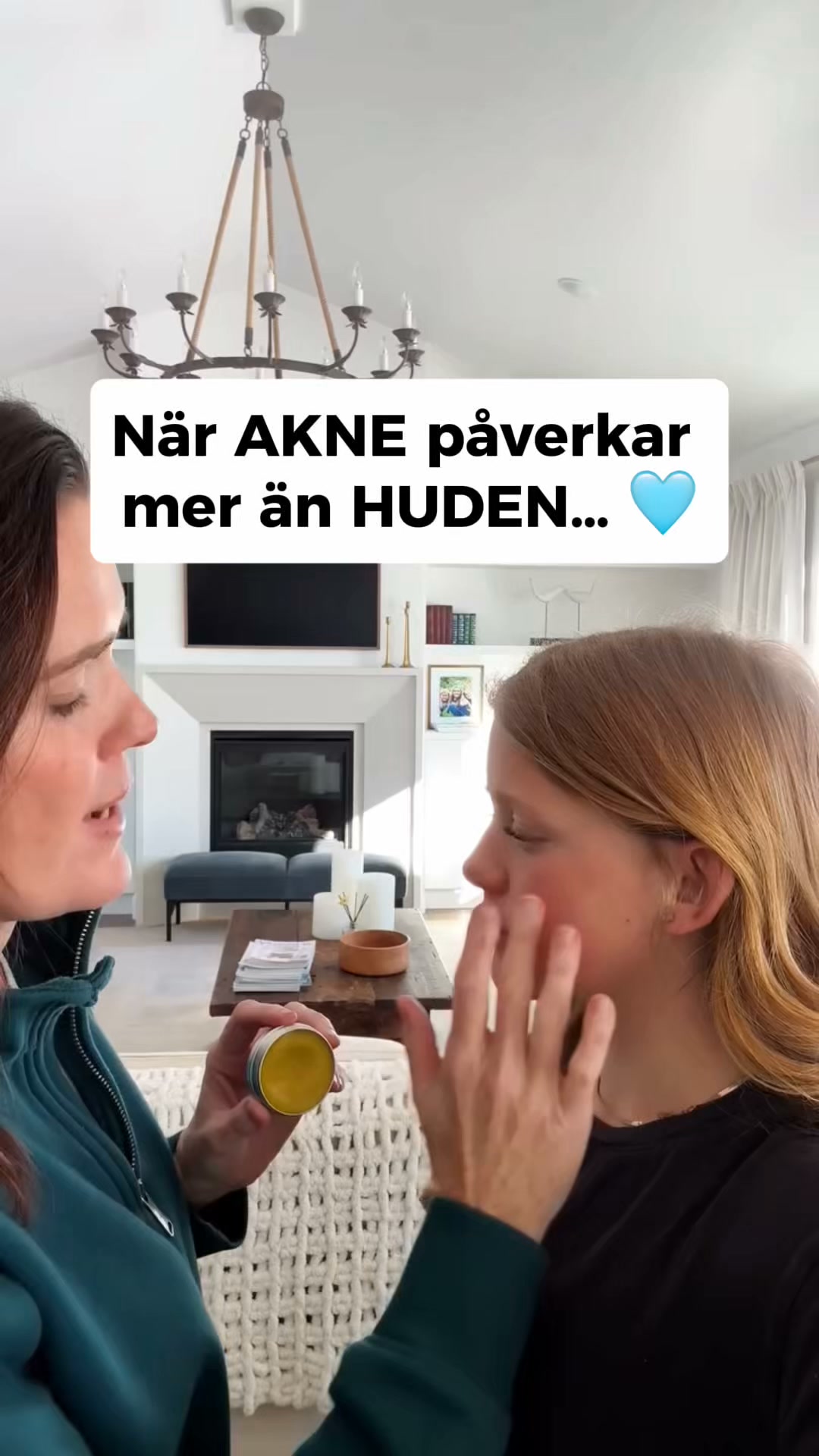 LovieBaby Facebook ad: Naturlig hudvård för akne