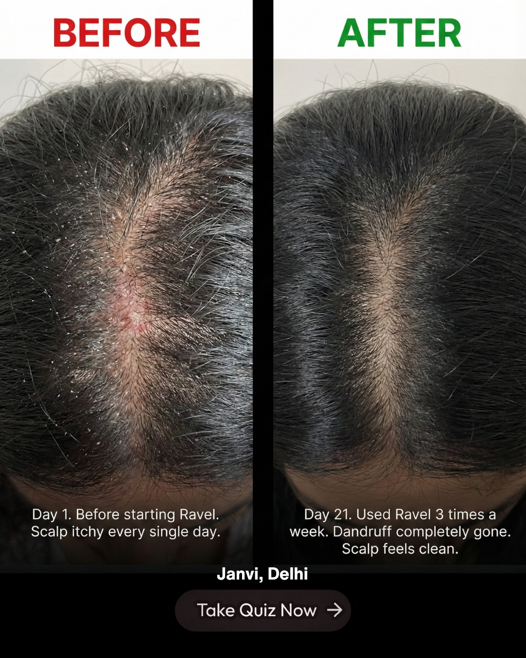 Ravelcare Facebook ad
