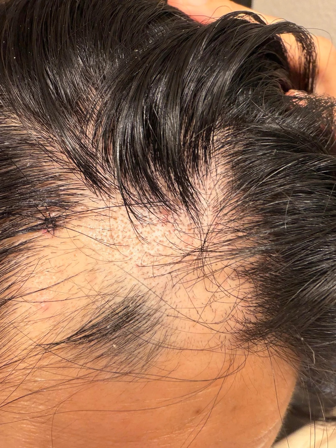 Sue Pascale Facebook ad: Goodbye To Hair Thinning