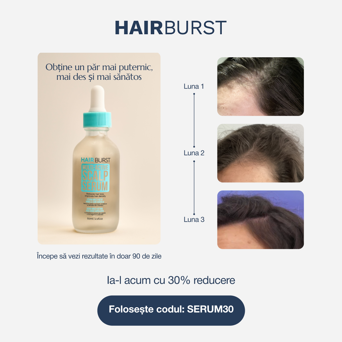 Hairburst Romania Facebook ad