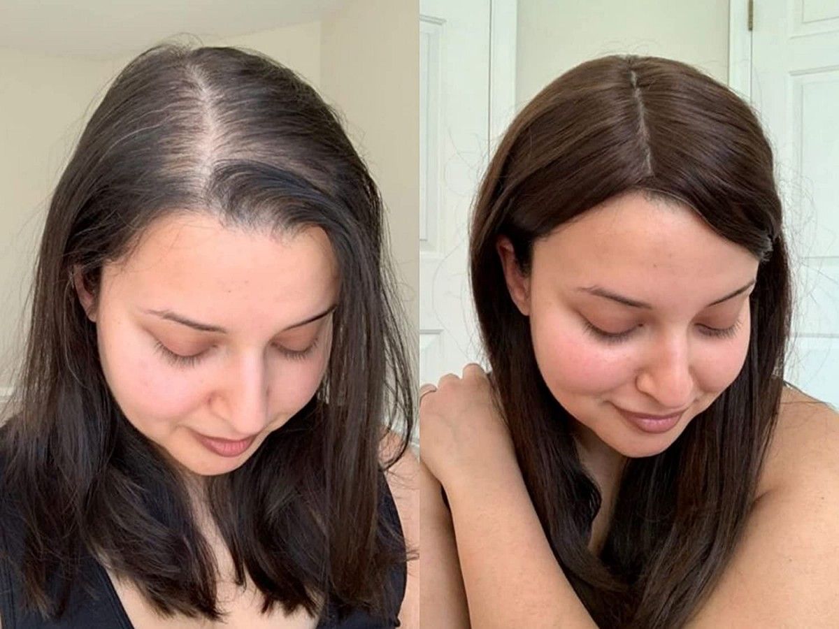 Jennifer Nelson Facebook ad: Reverse GLP-1 Hair Loss