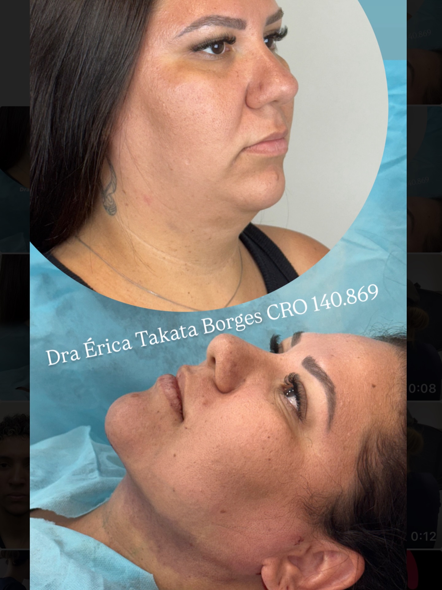 Dra Erica Takata Facebook ad: Antes e depois não é sobre mudar, é…