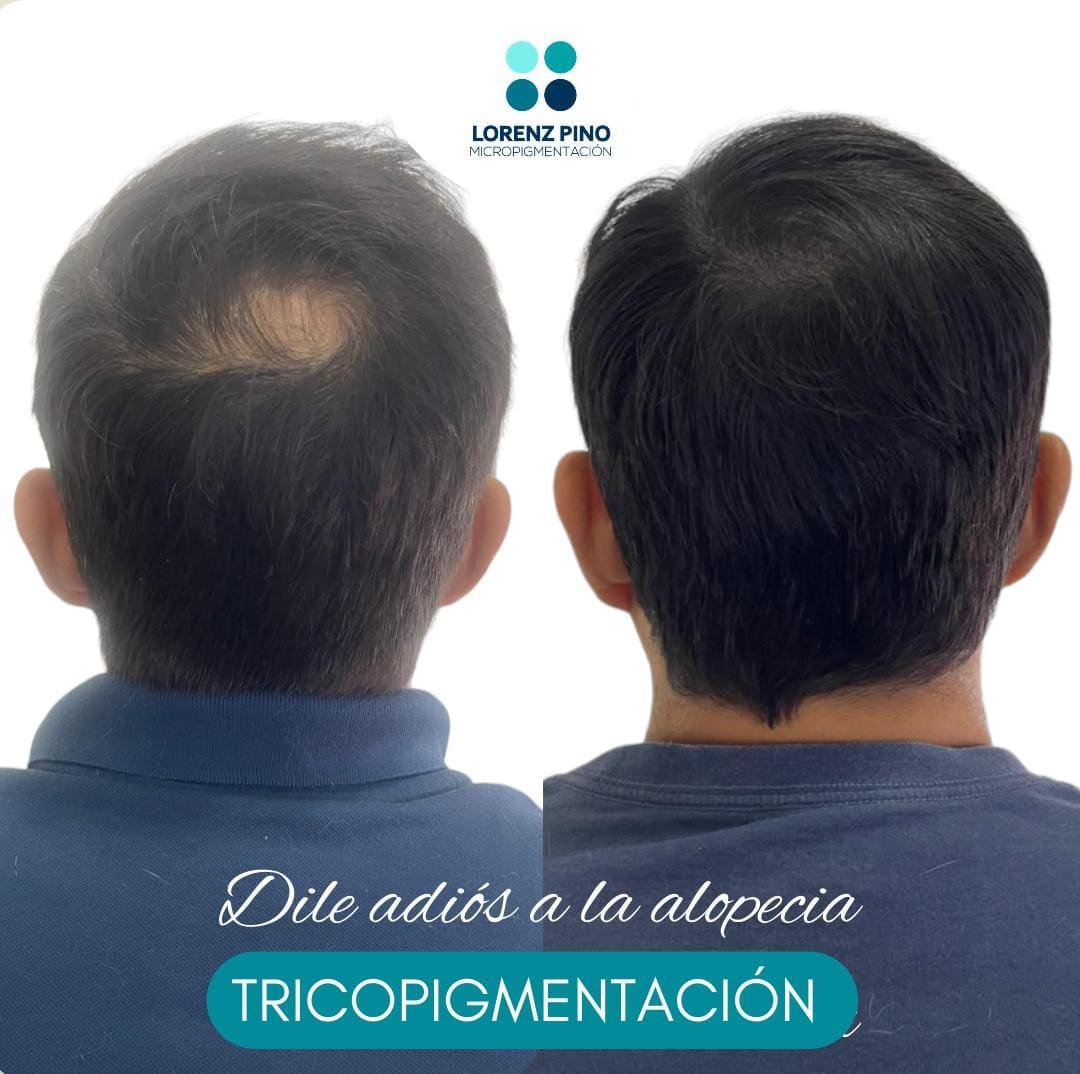Lorenz Pino Facebook ad: Consulta!