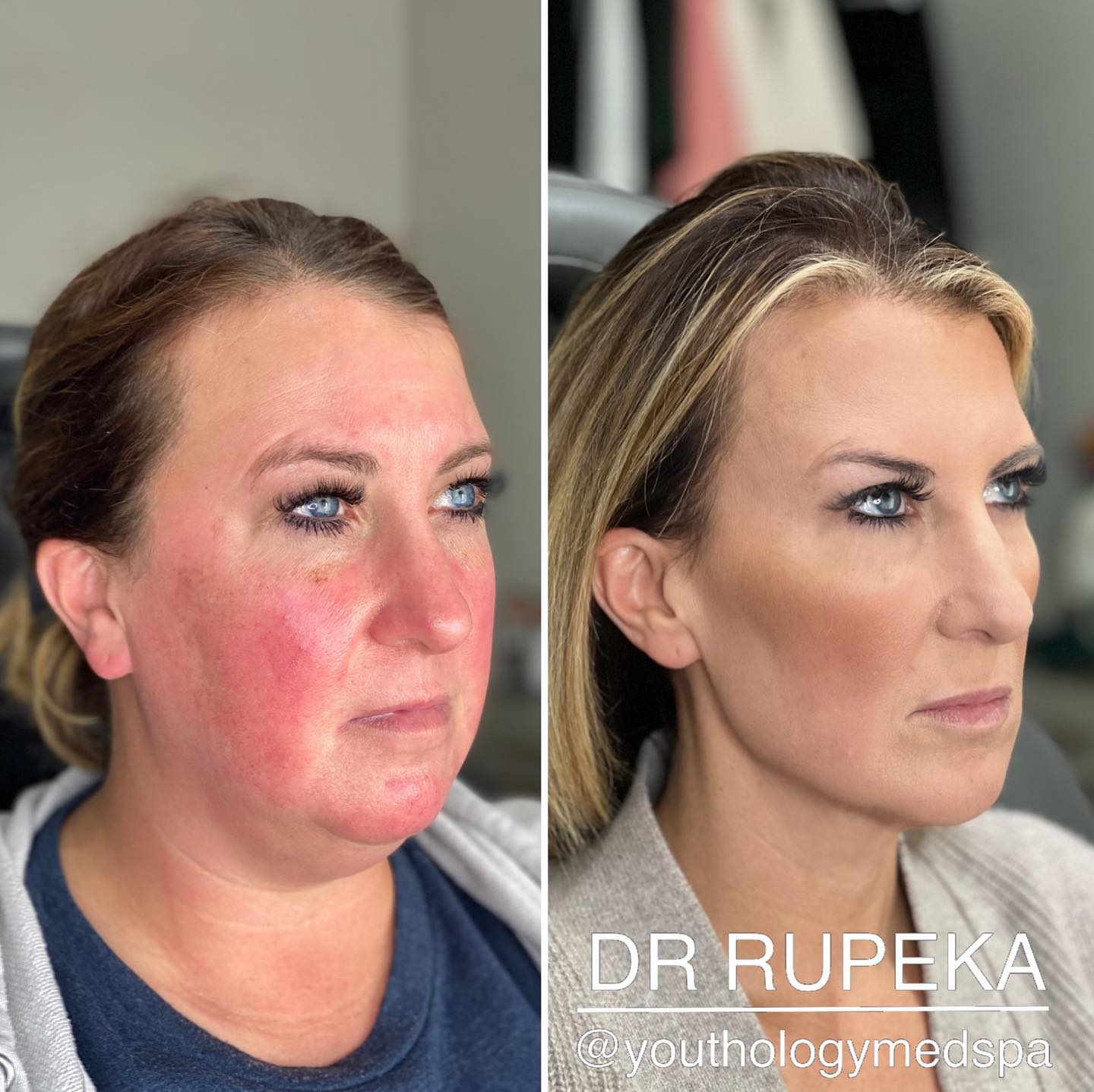 Youthology Medspa Facebook ad