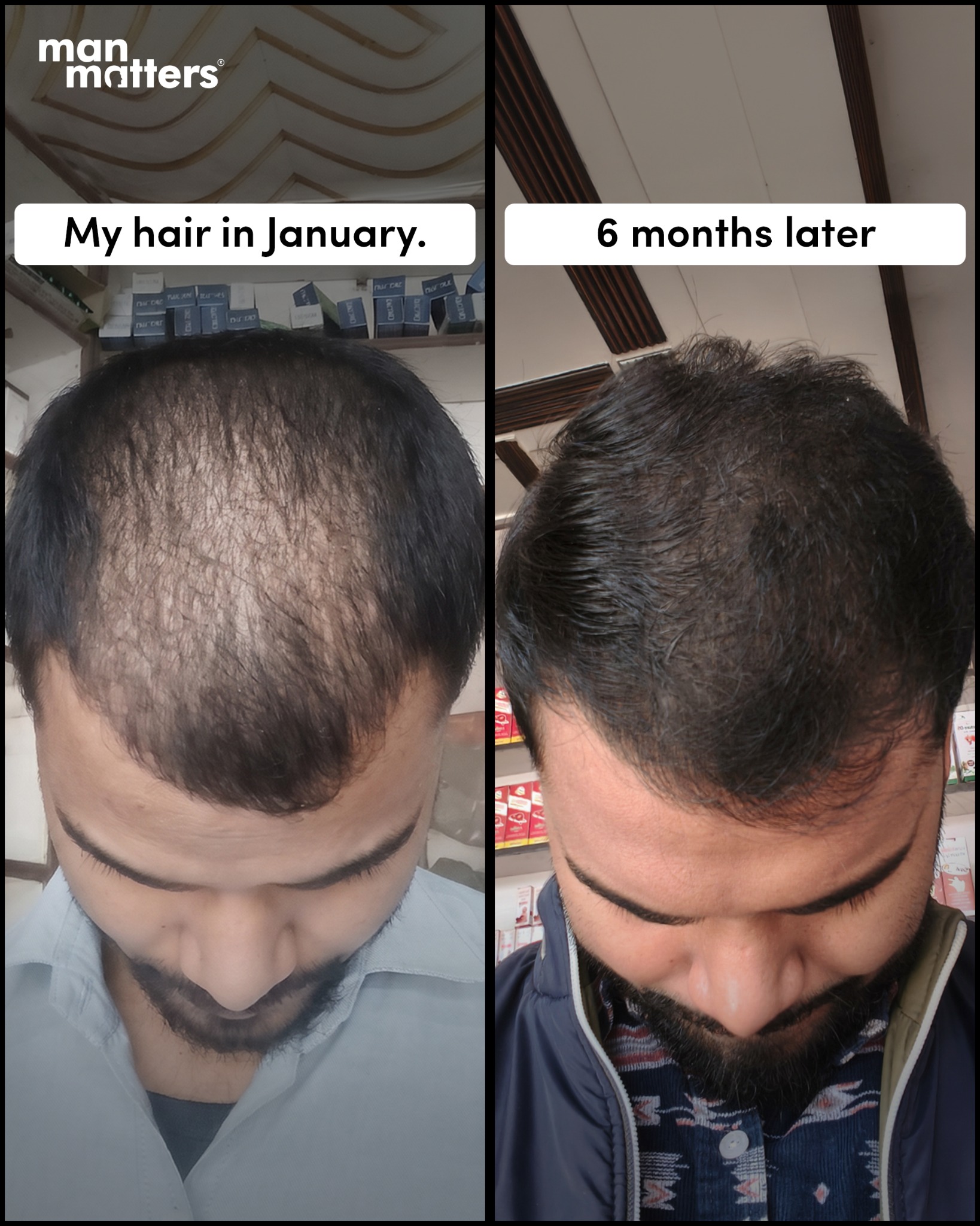 manmattershairwarriors Facebook ad