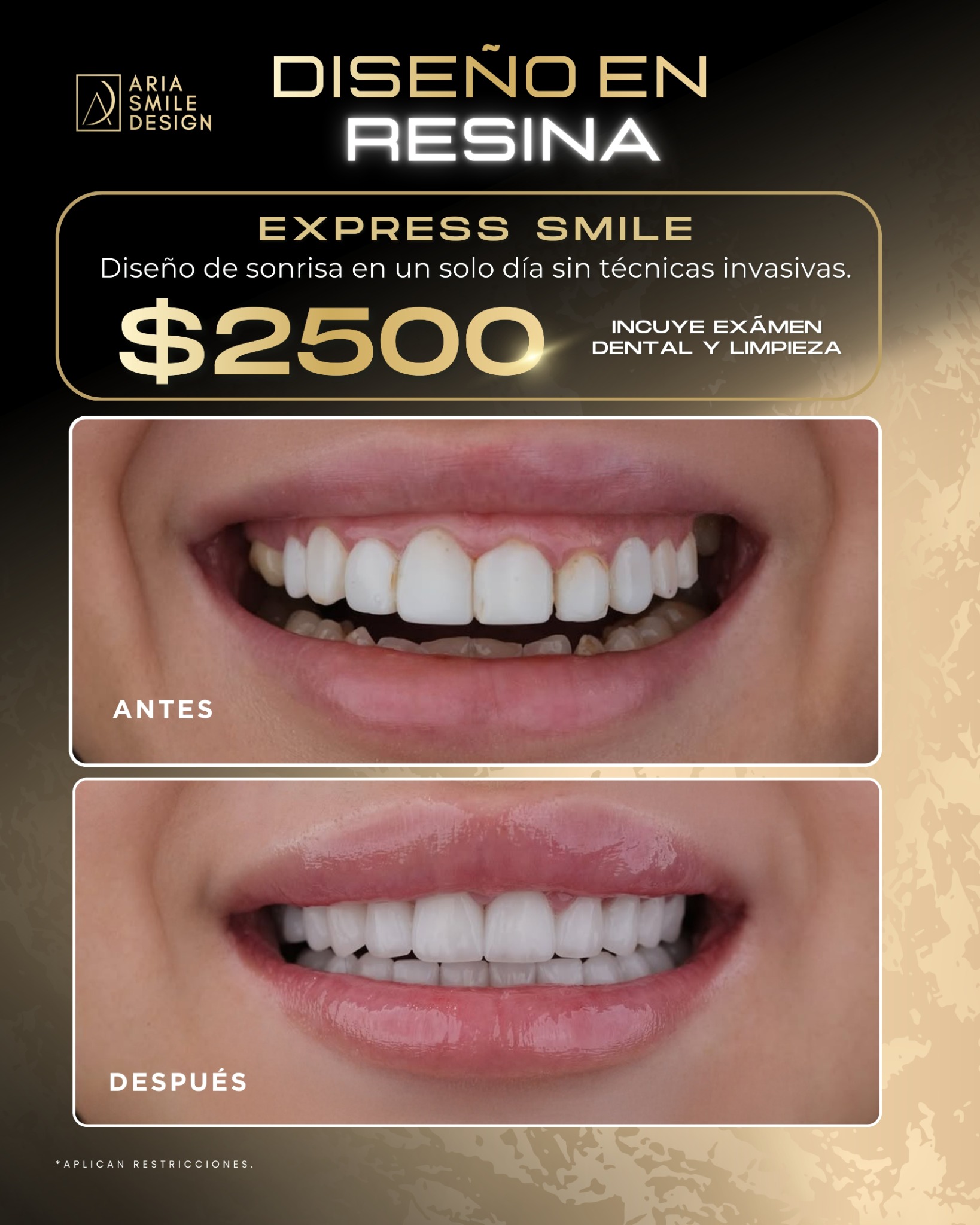 Aria Smile Design Facebook ad