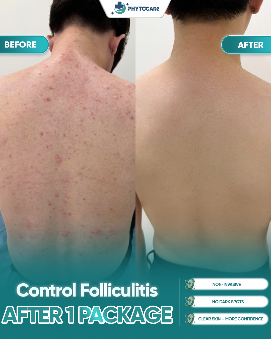 Cebu Phytocare Skin Clinic Facebook ad