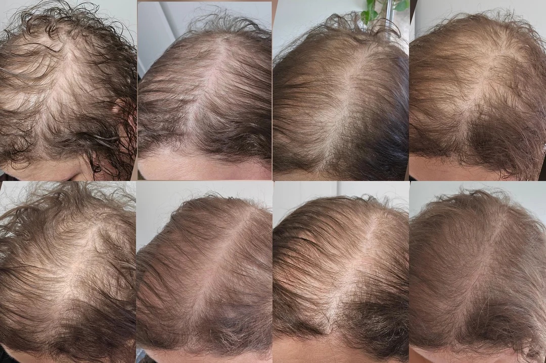 Karen Pascale, dermatologist Facebook ad: Goodbye To Hair Thinning