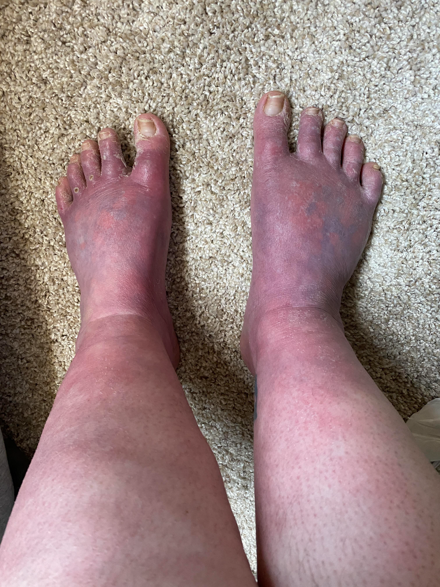 Swollen Legs Relief Facebook ad: Relieve Swelling Naturally