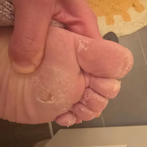 Nicole Parker Facebook ad: My doctor told me to wait until I finished breastfeeding…