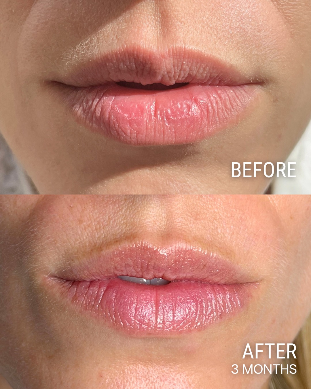 Contour Clinics Facebook ad