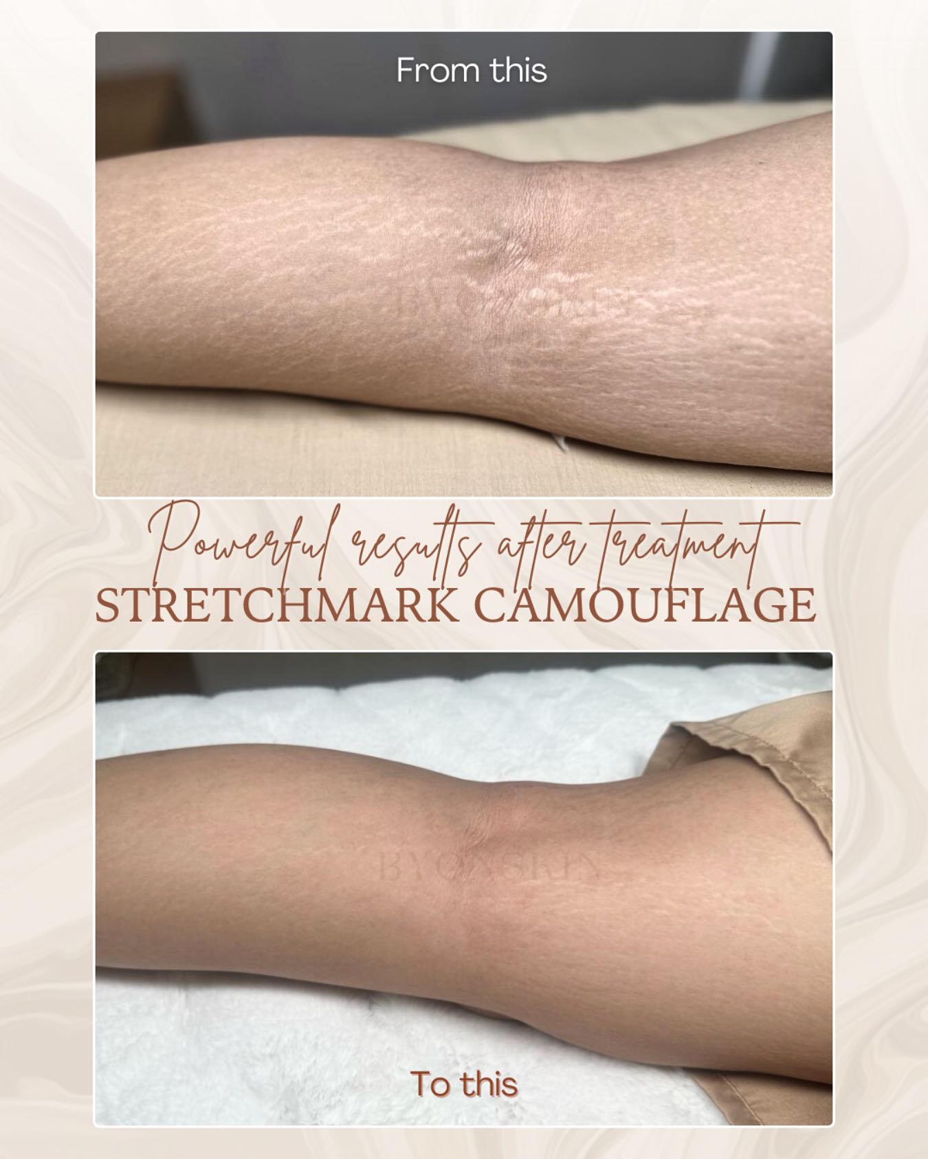 Byonskinpik Facebook ad