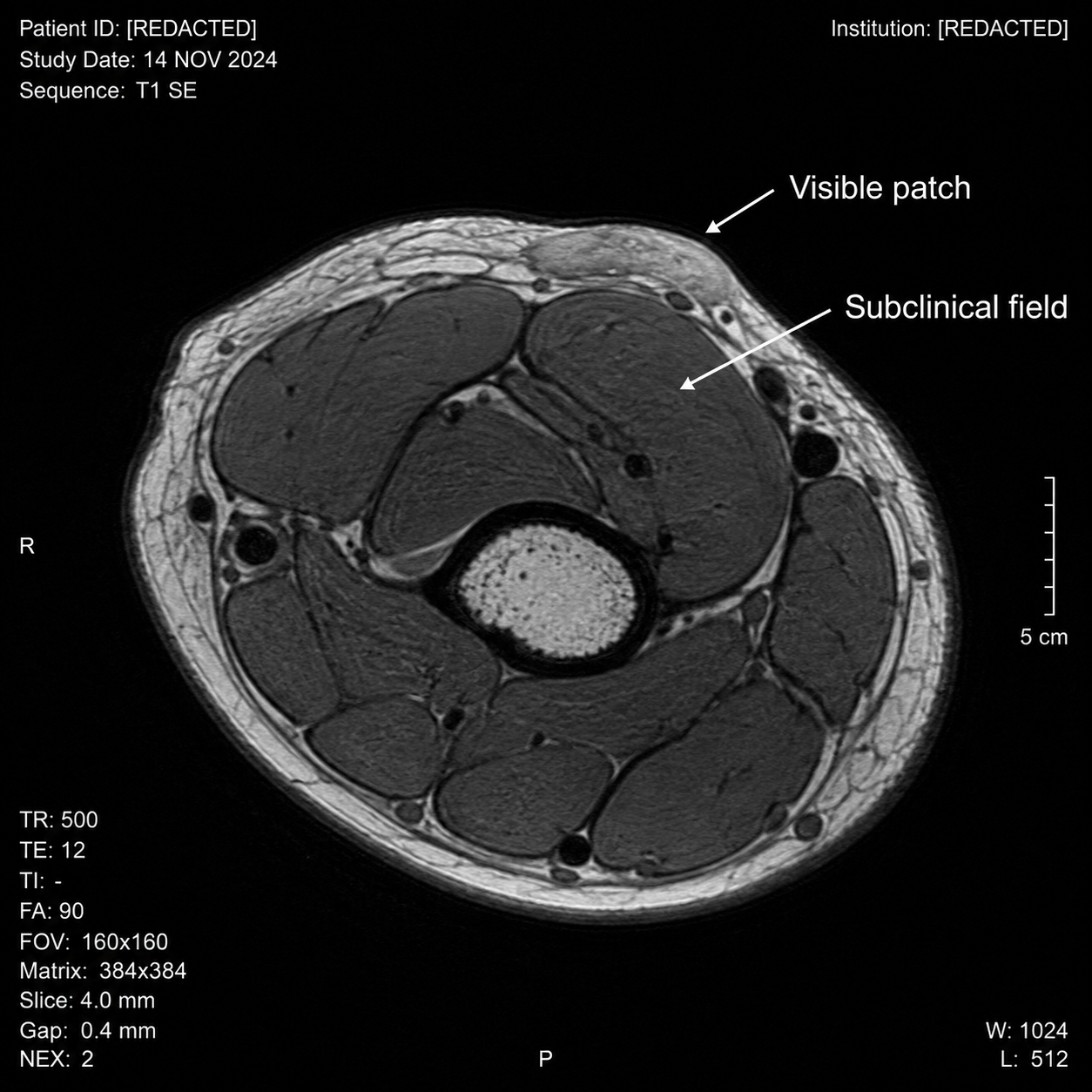 Actinic Keratosis Recovery Facebook ad: Your GP Treats the Arrow on Top. The One Below Is Why It…