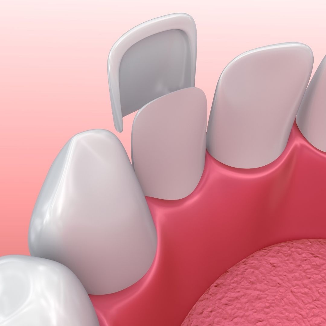 Dentist Near Me Riverside Facebook ad