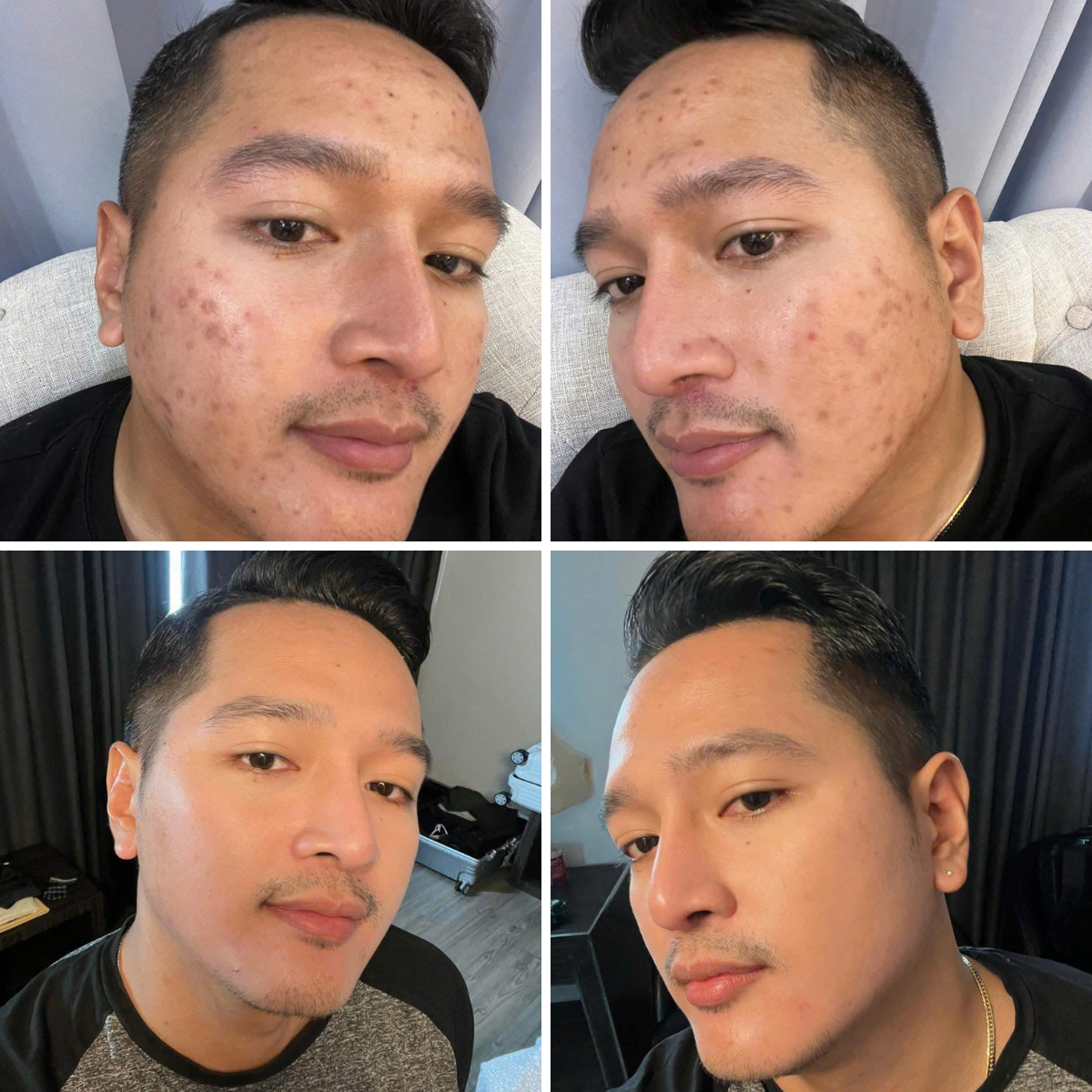 TRINA Beauty Facebook ad