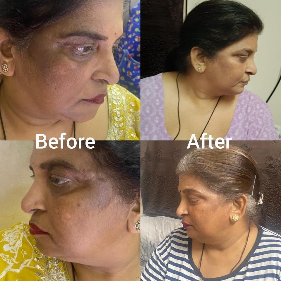Glitter glow Facebook ad: From Pigmentation to Glow