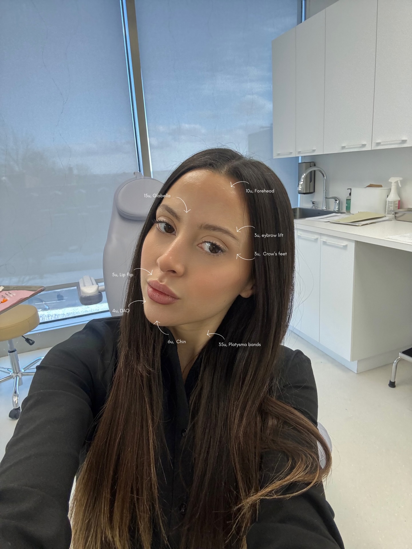 Naj Aesthetics Facebook ad: Prendre un rendez-vous chez Naj Aesthetics Montreal - 4150…