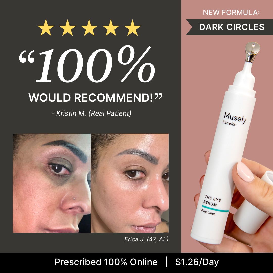 Musely FaceRx Facebook ad