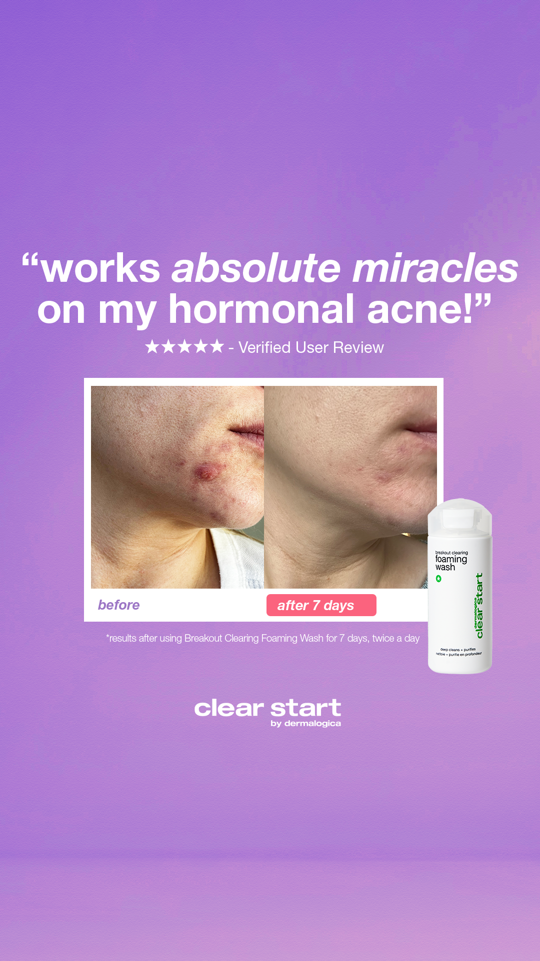 Dermalogica Facebook ad